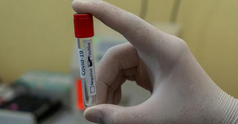 Iron Deficiency: A Hidden Factor in Long COVID, Researchers Say