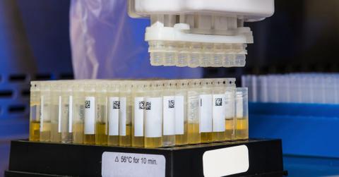 Scientists Determine Why Human Urine is Yellow in Color: Study