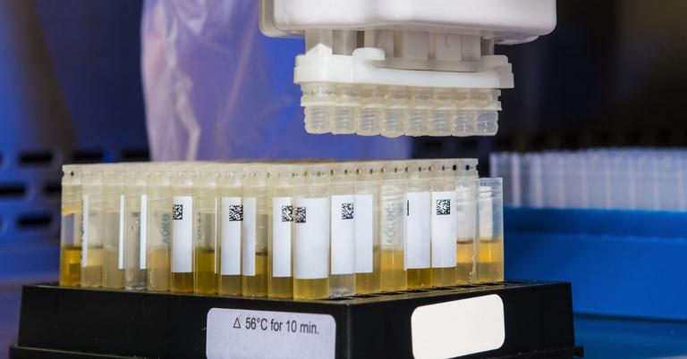 Scientists Determine Why Human Urine Is Yellow In Color: Study