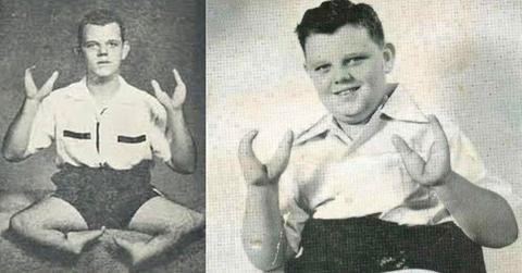 Lobster Boy Grady Stiles